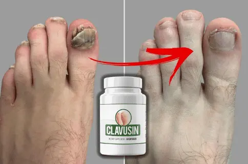 Clavusin Buy